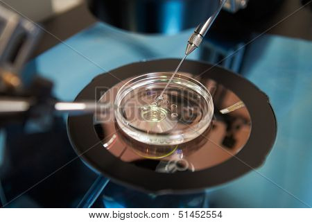Laboratory Fertilization Of Eggs In IVF Treatment