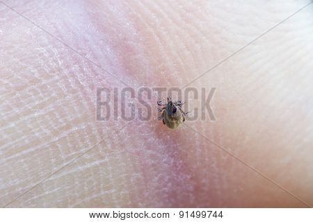 Mite On A Skin