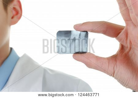 X-ray periodontitis tooth. Dentist holding a picture of a sick tooth