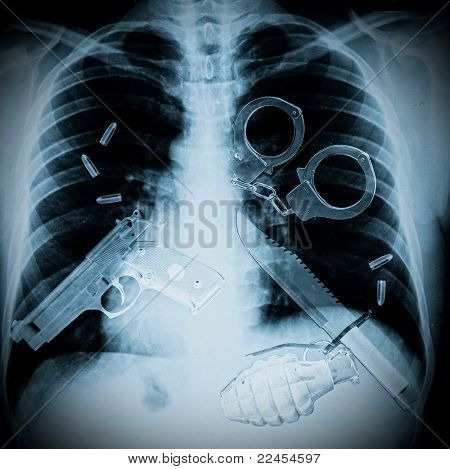tronco xray e armas diferentes, dentro