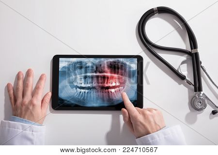 Doctor's Hand And Digital Tablet Screen Showing Teeth X-ray With Stethoscope On White Desk