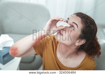 Curly Red-haired Woman Dropping Her Eyes Having Allergy