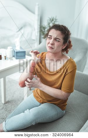 Woman Wearing Jeans And Orange Shirt Having Scratches On Arm