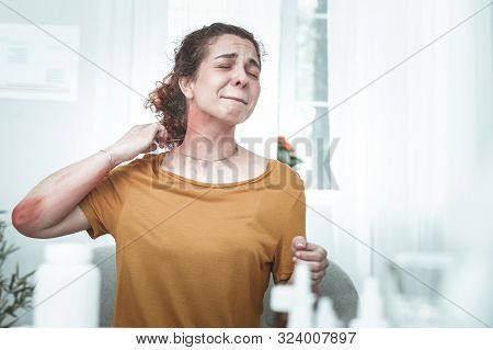 Woman Having Rash On Her Neck And Arms Because Of Allergy