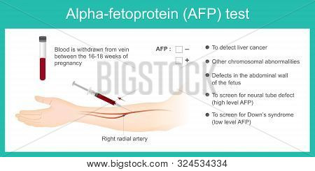 Alpha-fetoprotein Afp Test. Use Analysis By Afp Level. To Detect Liver Cancer, And Use To Screen For