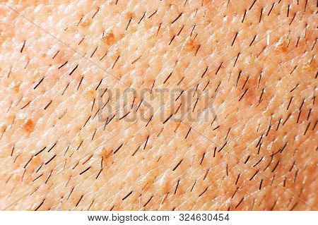 Male Stubble Close. Unshaven Male Cheek. Unshaven Face Of A Man