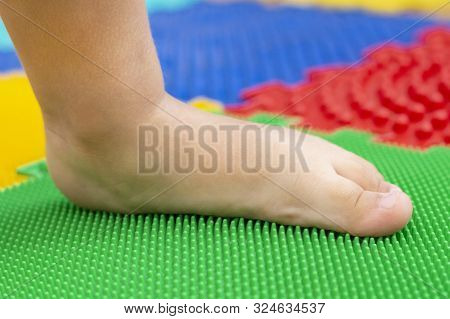 Treatment And Prevention Of Flat Feet In Children. A Small Child Walks Barefoot On An Orthopedic Mat