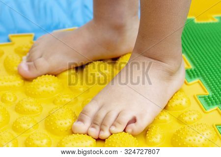 Treatment And Prevention Of Flat Feet In Children. A Small Child Walks Barefoot On An Orthopedic Mat