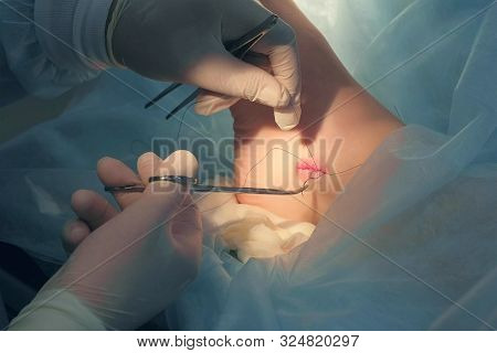 Surgeon Man Sutures Ankle During Surgery With Neat Stitches After Removing Hygroma, Hands Closeup. D
