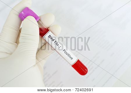 Bird Flu positive