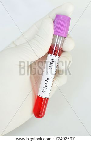 H5N1 positive