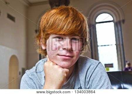 Cute Boy With Red Hair