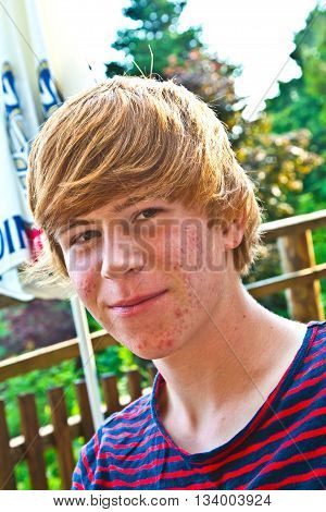 portrait of cute boy with red hair in puberty