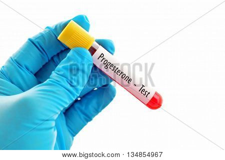 Test tube with blood sample for progesterone test