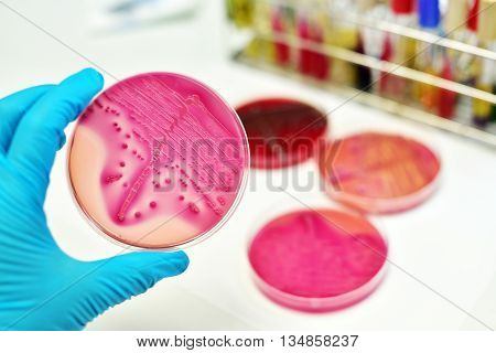 Colonies of bacteria in culture medium plate