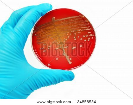Colonies of bacteria in culture medium plate