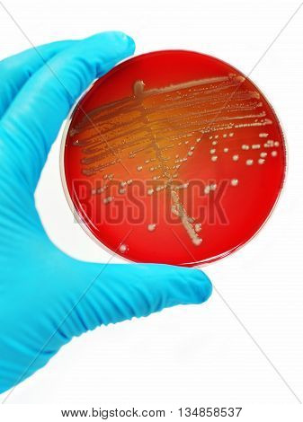 Colonies of bacteria in culture medium plate