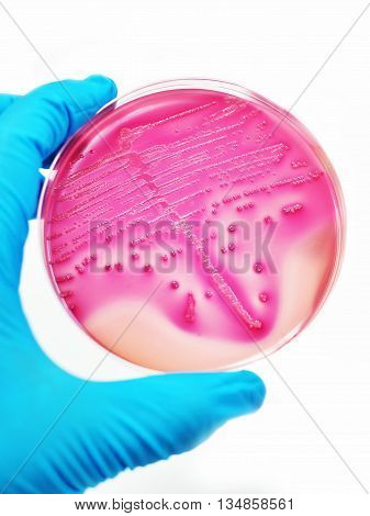 Colonies of bacteria in culture medium plate