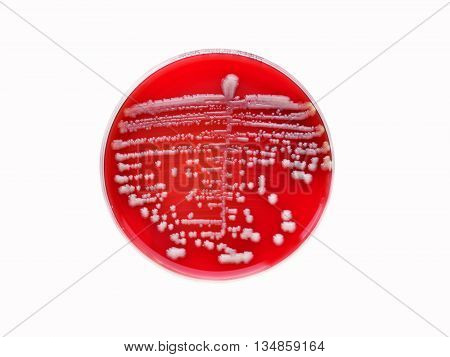 Colonies of bacteria in culture medium plate