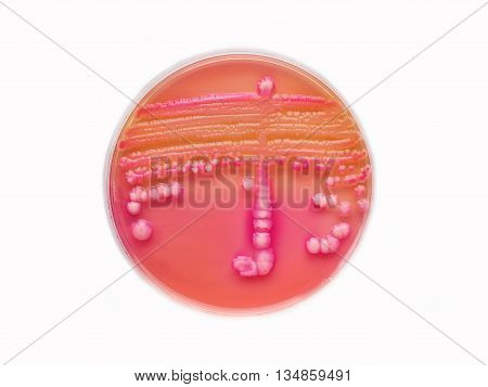 Colonies of bacteria in culture media plate