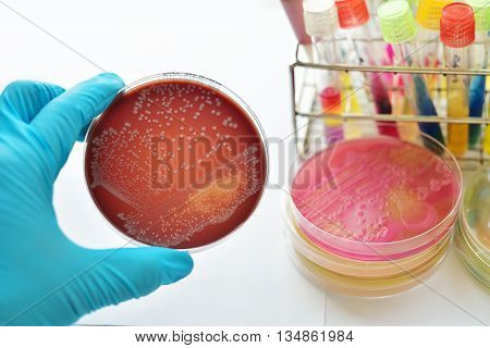 Colonies of bacteria in culture medium plate