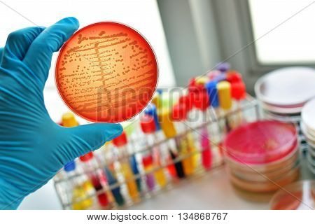 Colonies of bacteria in culture medium plate