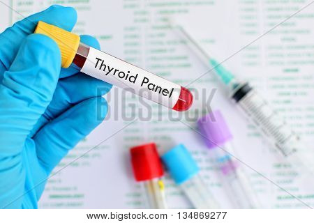 Test tube with blood sample for thyroid hormone test
