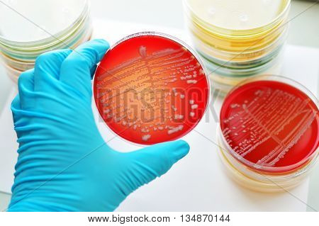 Colonies of bacteria in culture medium plate