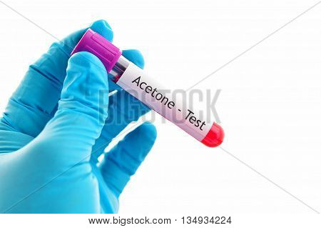 Test tube with blood sample for acetone test