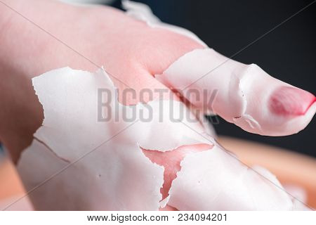 Process Paraffin Treatment Of Female Hands In Beauty Salon