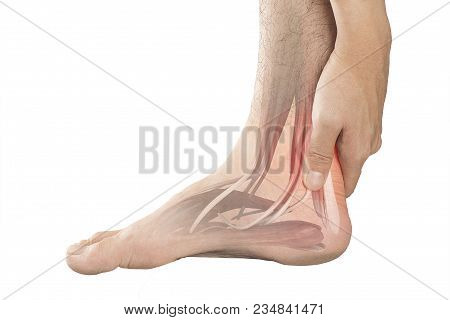 Heel Muscle Pain White Background Heel Injury