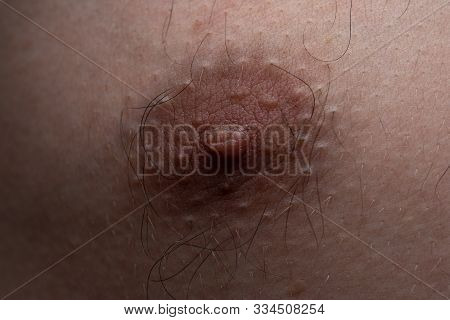 Image Of Hairy Mans Nippel, Macro Shooting
