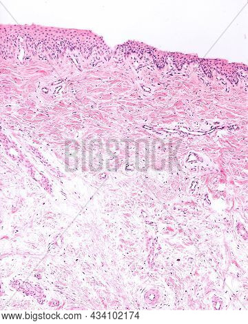 Nail Bed. In This Region, The Epithelium (above) Presents A Poor Development Of The Dermal Papillae 