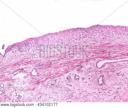 Nail Bed. In This Region, The Epithelium (above) Presents A Poor Development Of The Dermal Papillae 