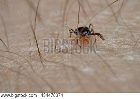 Mite Arachnid Parasite Insect On The Skin Macro Transmitting Encephalitis Virus Or Lyme Borreliosis 
