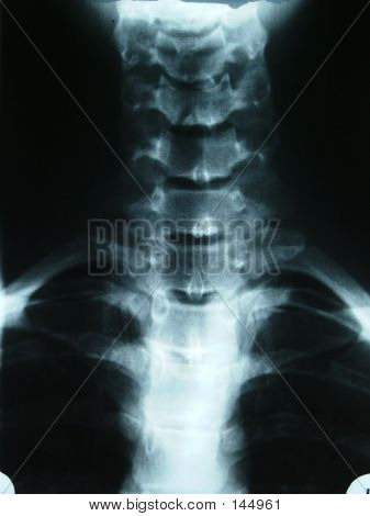 X-ray