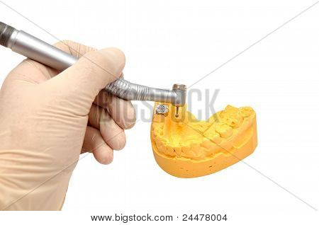 牙科模具和苍耳