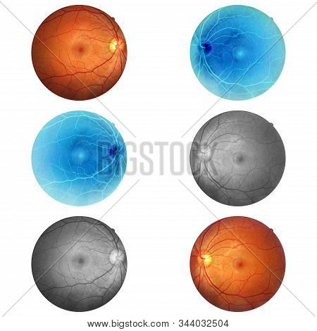 Human Eye Anatomy Taking Images With Mydriatic Retinal Cameras