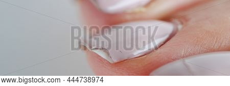 Broken Female Nails With Manicure. Weak And Brittle Nails Concept