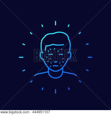 Acne Icon, Skin Problem, Rash Linear Design
