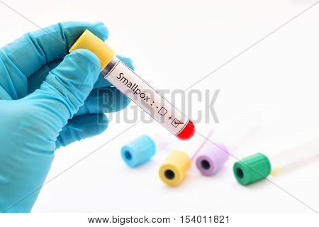 Blood sample positive with smallpox virus test