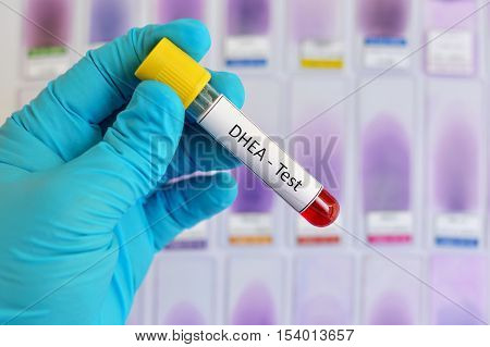 Blood sample for DHEA (dehydroepiandrosterone) hormone test