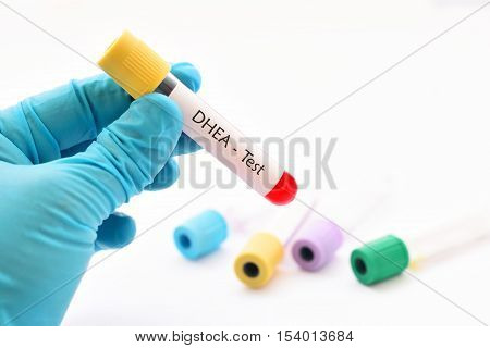 Blood sample for DHEA (dehydroepiandrosterone) hormone test