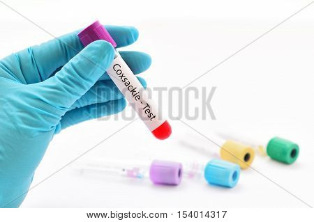 Test tube with blood sample for Coxsackie virus test