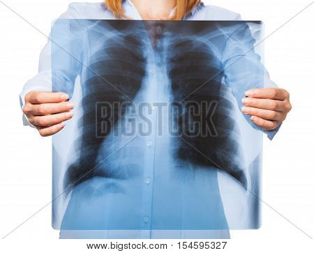 Woman holds lunges x-ray over her chest with hands
