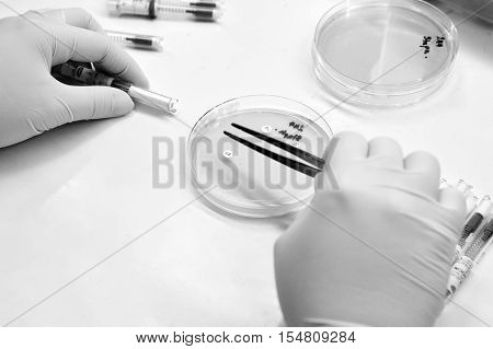 Bacterial Culture And Drug Resistance Of Pathogens In Laboratory.