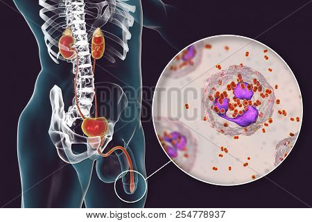 Male Gonorrhea, Medical Concept. 3d Illustration Showing Close-up View Of Neisseria Gonorrhoeae Bact