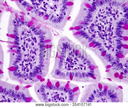 Cross-sectioned Intestinal Villi Stained With Pas-hematoxylin. The Mucous Secretion Of The Goblet Ce