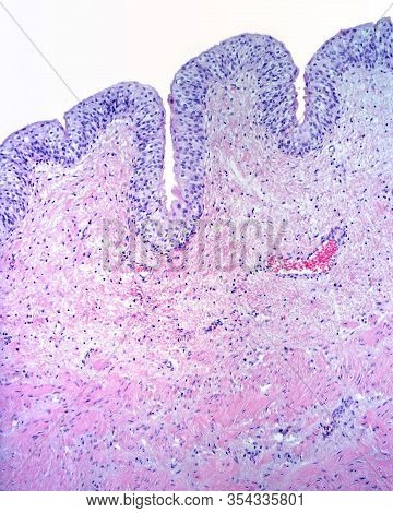Mucosa Of The Urinary Bladder Formed By A Transitional Epithelium And A Lamina Propria Of Connective