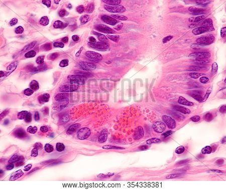 High Magnification Micrograph Of Paneth Cells Showing Very Large Eosinophilic Granulations. They Are